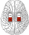 Magnetic fields in the Brain